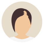 Kosten bei Haartransplantation-für Frauen-Beste Haarklinik Schweiz-Hairthetic-Geheimratsecken-min