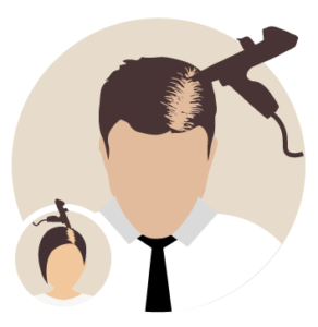 Mesotherapie bei Haarauswahl - Beste Haarklinik Schweiz - Hairthetic