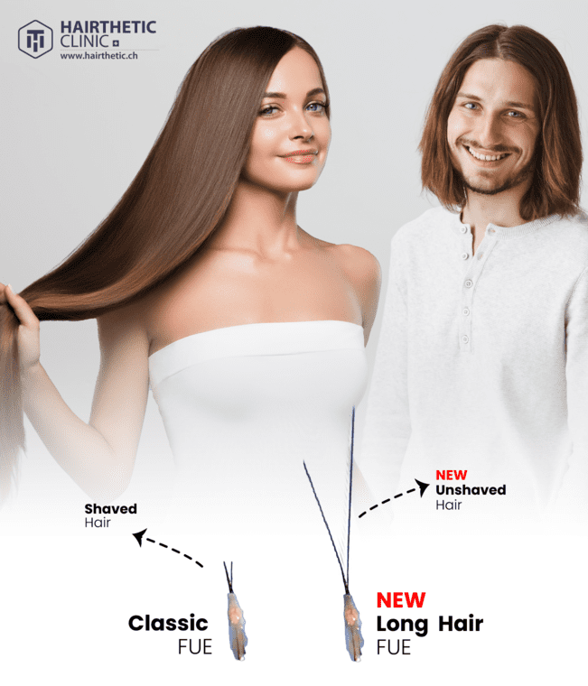 Lange Haartransplantation - Long Hair Transplant Switzerland Beste Hair Clinic Hairthetic (1)