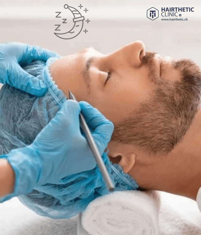 Soft Sleep Methode Haartransplantation Hairtransplant - Schweitzerland Schweiz Zürich - Hairthetic Med Of Swiss