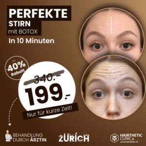 Falten weg mit Botox Behandlung stirn Face sliming Hairthetic Zuerich Schweiz